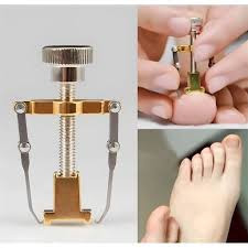 گیره ارتودنسی ناخن ارتونیل درجه یک